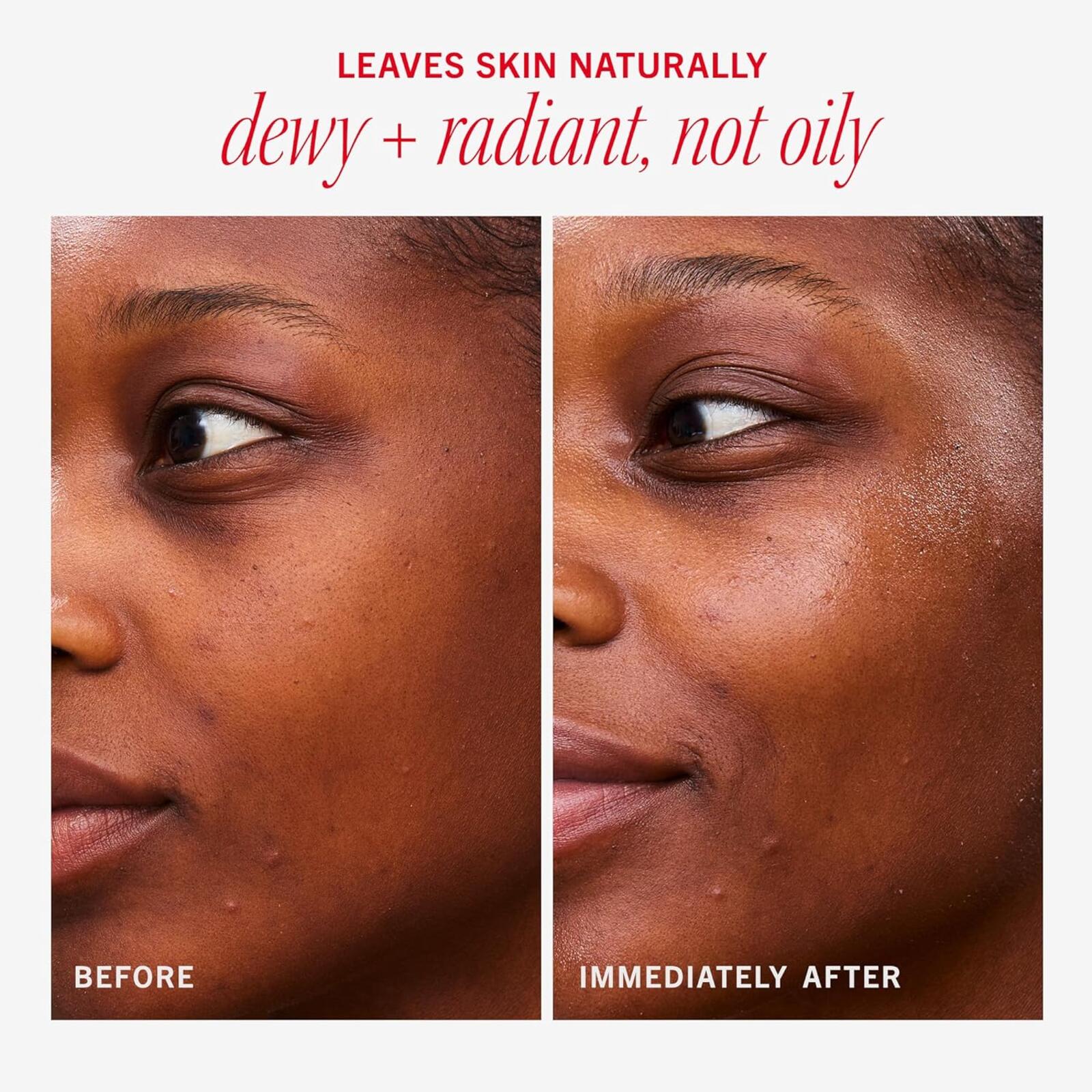 First Aid Beauty Hydrating Dewy Gel Cream (1.9 oz)