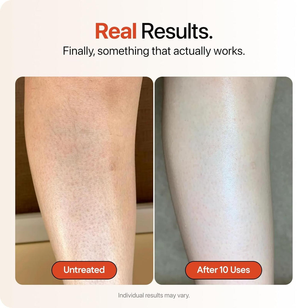 Strawberry Ultra Strength Skin Resurfacing Cream 4oz Triple Acid Complex + B3