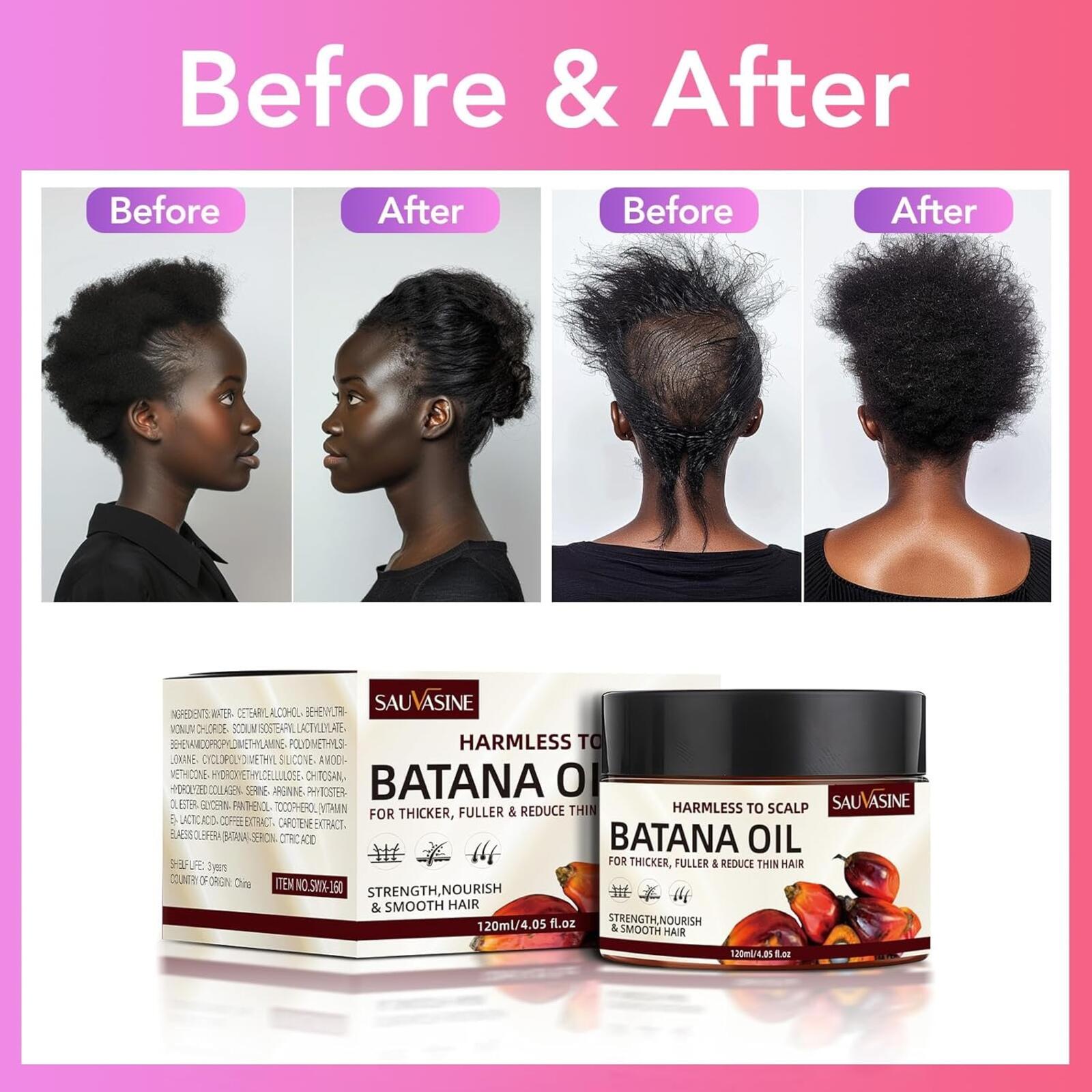 SAUVASINE Batana Oil for Thicker Fuller Hair 120ml - Nourish & Strengthen